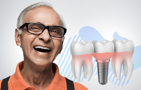 Fixed teeth in a day
